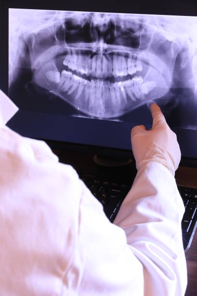 Best Chipped Tooth Repair Near Me  in Fairland, OK