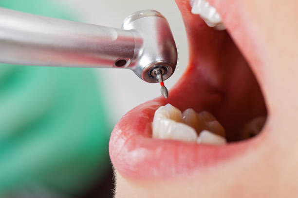 Best Tooth Infection Emergency Dentist  in Fairland, OK
